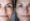 Comp_Before After Treatments HD